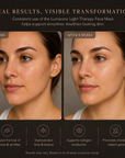 Lumacore Light Therapy Face Mask